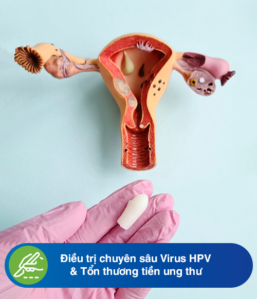 Điều trị chuyên sâu Virus HPV & Tổn thương tiền ung thư