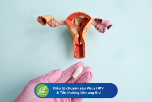 Điều trị chuyên sâu Virus HPV & Tổn thương tiền ung thư