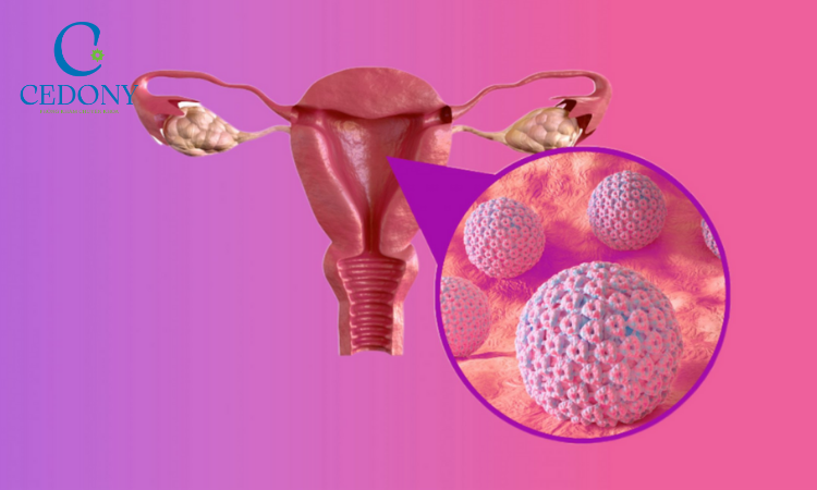 Virus HPV tồn tại lâu dài có thể tiến triển thành ung thư
